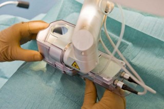 chirurgie laser des yeux pour corriger la myopie, la presbytie, l'hypermétropie et l'astigmatisme